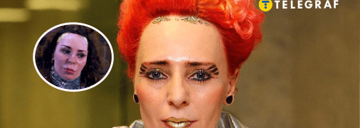 Жанна Агузарова до и после пластики