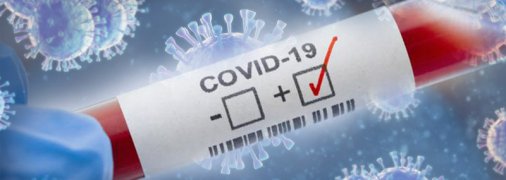 В обхід ПЛР-тестів: російські туристи летять відпочивати за кордон з гострою формою коронавірусу (відео)