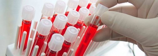 ОАК - обязательный анализ при ковиде