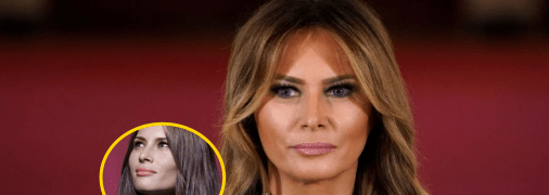 Мелания Трамп до и после пластики