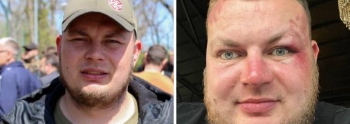 Праворуч - активіст через день після побиття