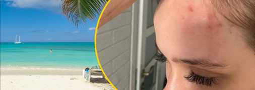 Стан здоров'я дівчини різко погіршився