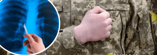 Військова служба з обмеженням