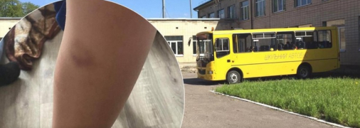 "Таким сина ще не бачила": в полтавському ліцеї намагався накласти на себе руки 8-річний хлопчик (фото)