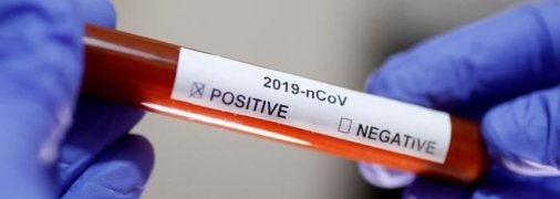 Кількість заражень коронавірусом за добу в Україні обчислюється тисячами