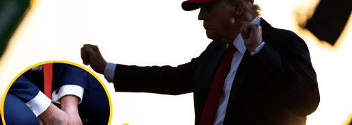 Розмови про гематоми Трампа не вщухають