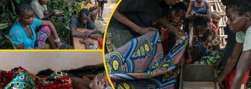 Эпидемия кори в Конго забирает жизни детей