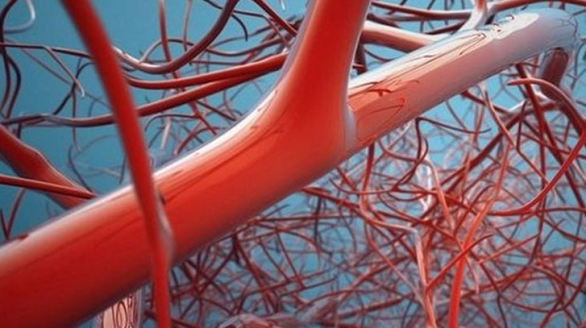 Как чистить сосуды в домашних условиях быстро и эффективно - Телеграф